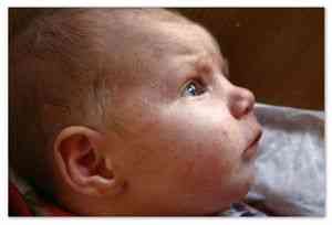Стафилококк у новорожденных: принципы лечения, виды и особенности ...
